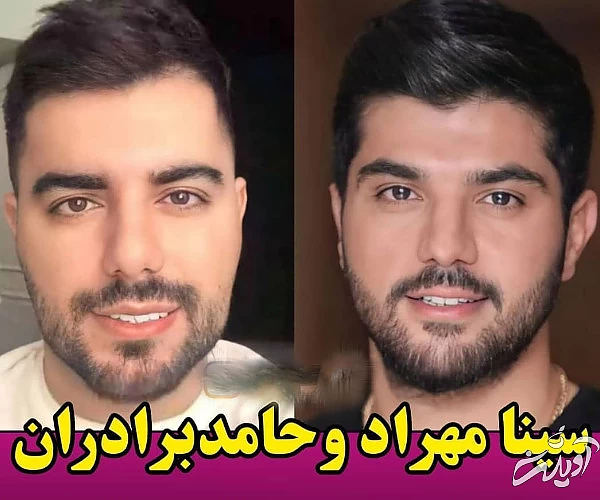 بدل سلبریتی ها